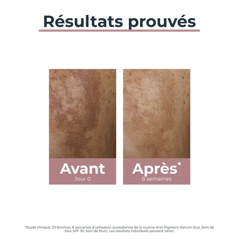 Eucerin Anti-Pigment Sérum Duo 30 ml – vue 5