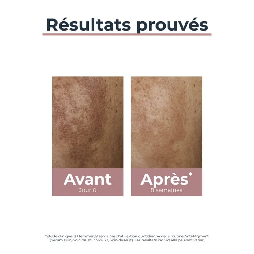 Eucerin Anti-Pigment Soin de Jour SPF 30 50 ml – vue 5