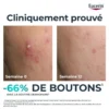 Eucerin DermoPure Clinical Triple Action Sérum 40 ml – vue 5